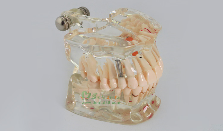 TM-C2 StandardTransparent
